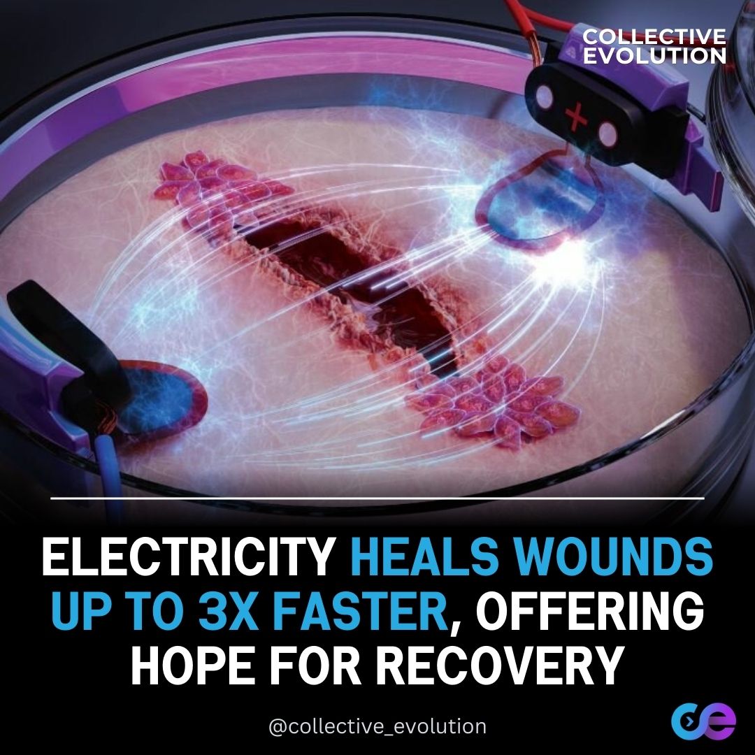 Na tento príbeh som použil AI a pýtal sa jej správne otázky. Keď som to spočítal, naozaj vyšlo 3x rýchlejšie hojenie rán. Ak dobre vidím a nepomýlil som sa niekde :)