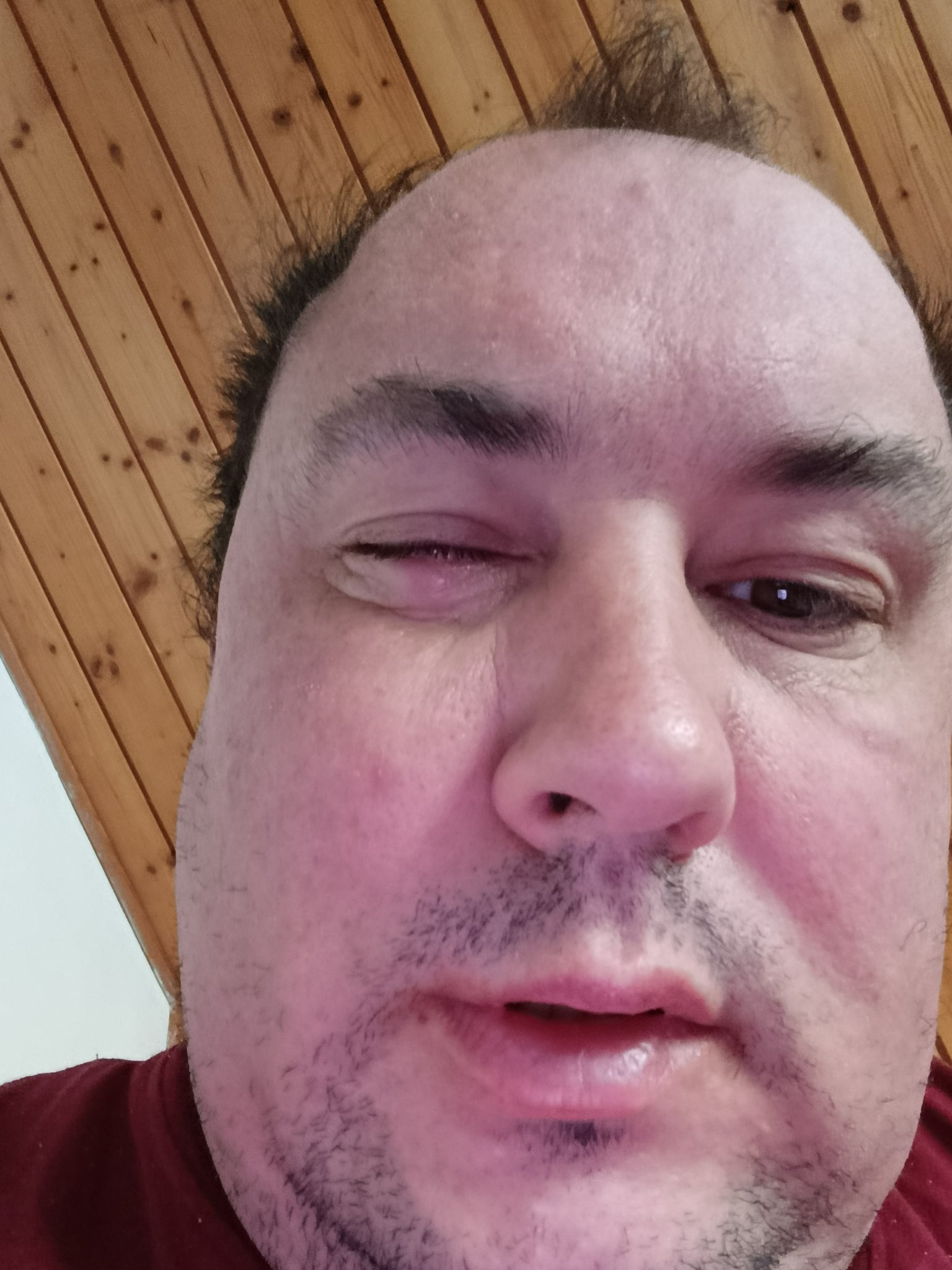 Bez komentára: Napadli ma Slováci: