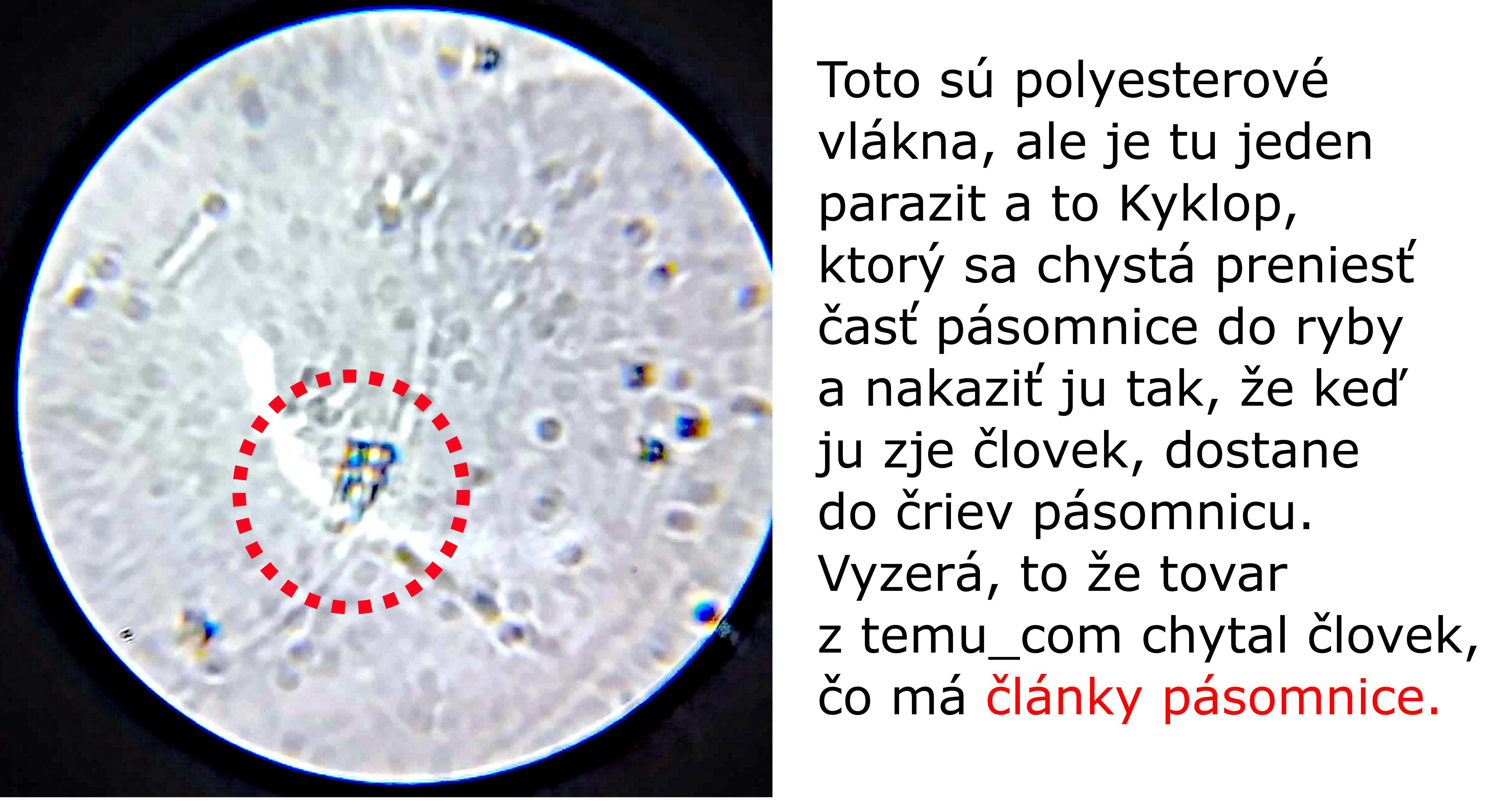 Komentár: Kamaráti z Číny nám zrejme posielajú články pásomnice od nakazeného Číňana a po veľkej si neumyl dobre ruky. Sú všade, obrázok: