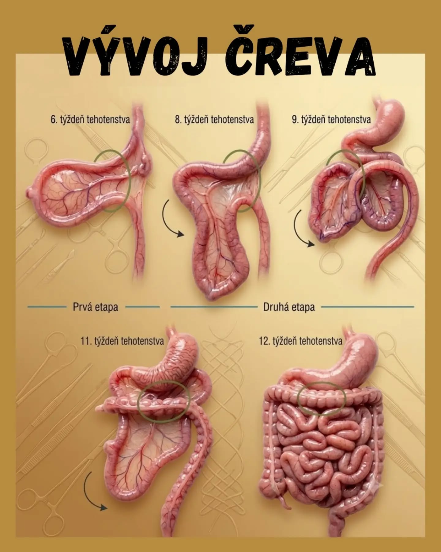 Komentár: Je lepšie ukladať črevá pri operácií spôsobom A alebo B, za mňa spôsobom vľavo A na simulácií, teda s cievami mierne obkročmo nie rovnakou stranou: