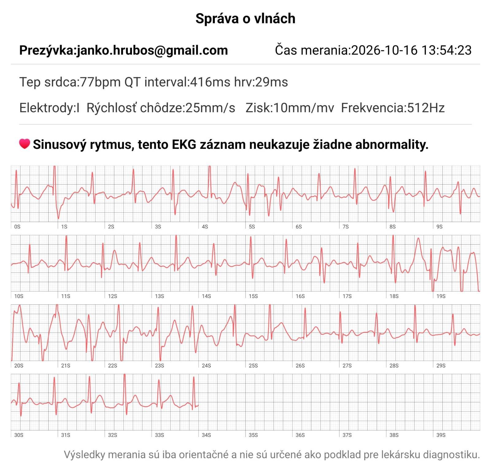 Komentár: Dnes v roku 2026 už nemusíš navštevovať drahé EKG u lekára, vybavíš to aj sto evrovými hodinkami na ruke Angelo watch AT200, takto to vyzerá v obrázkoch: